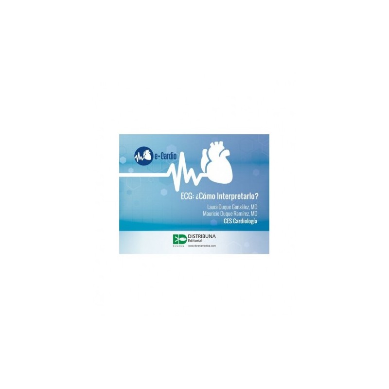 ECG: ¿Cómo interpretarlo?