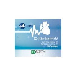 ECG: ¿Cómo interpretarlo?