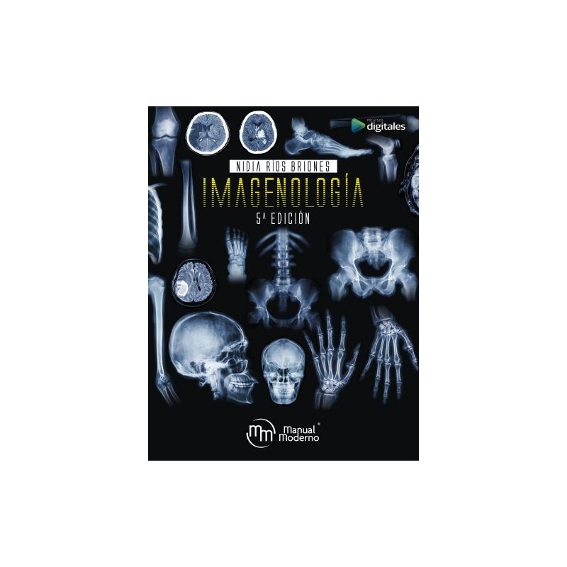 Imagenología. Ríos Briones, Nidia Isabel
