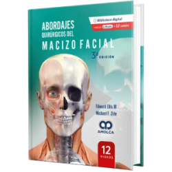 Abordajes Quirúrgicos del Macizo Facial  3a EDICIÓN.