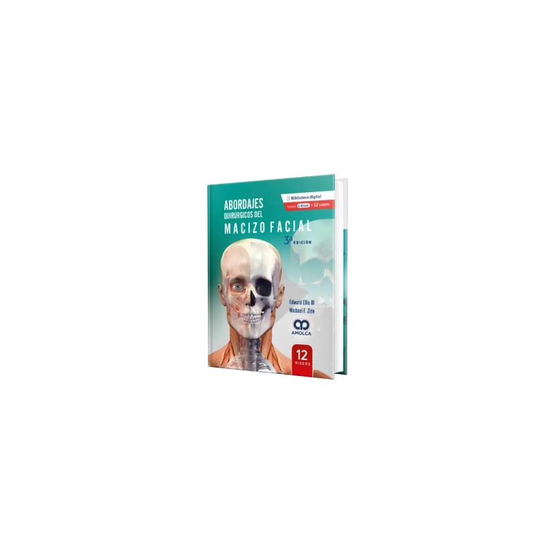 Abordajes Quirúrgicos del Macizo Facial  3a EDICIÓN.