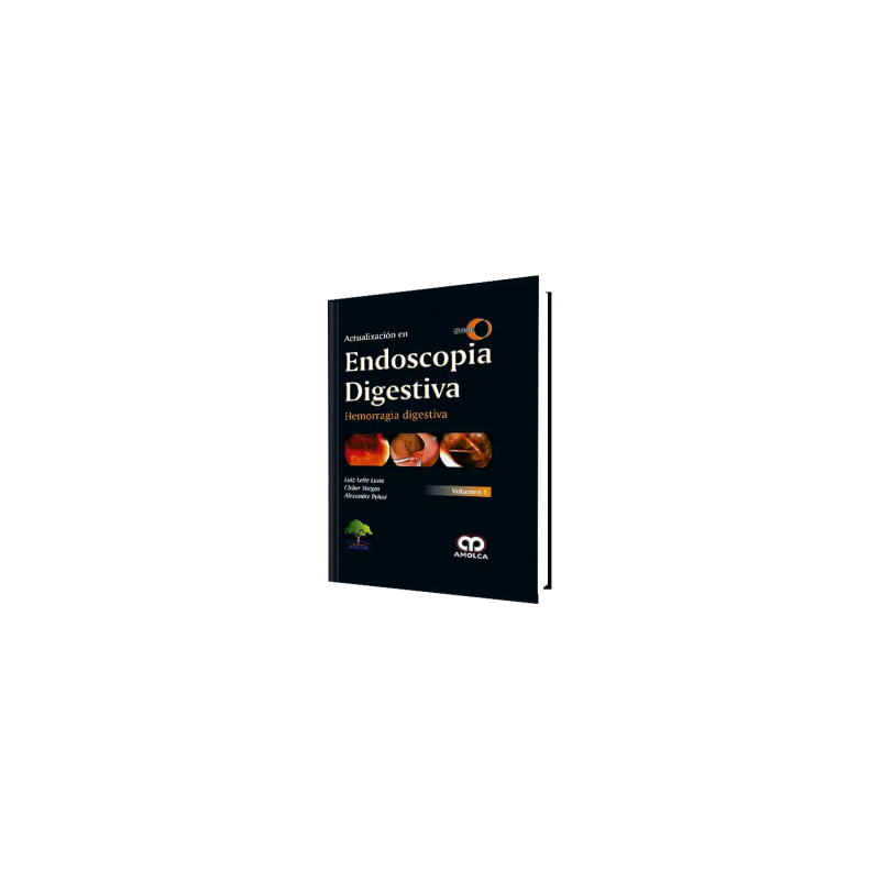 Actualización en Endoscopia Digestiva.  Volumen I. SOBED