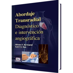 Abordaje Transradial  Diagnóstico e Intervención Angiográfica