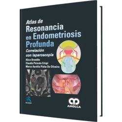 Atlas de Resonancia en Endometriosis Profunda