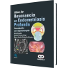 Atlas de Resonancia en Endometriosis Profunda