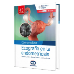 Como realizar una  Ecografía en la  Endometriosis.