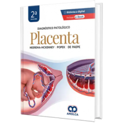 Diagnóstico Patológico.  Placenta. 2da Edición