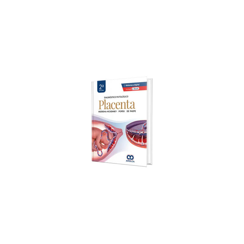 Diagnóstico Patológico.  Placenta. 2da Edición