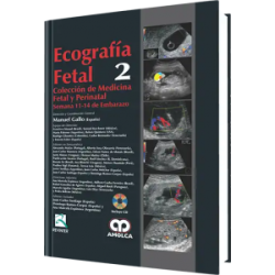 Ecografía Fetal  No. 2.